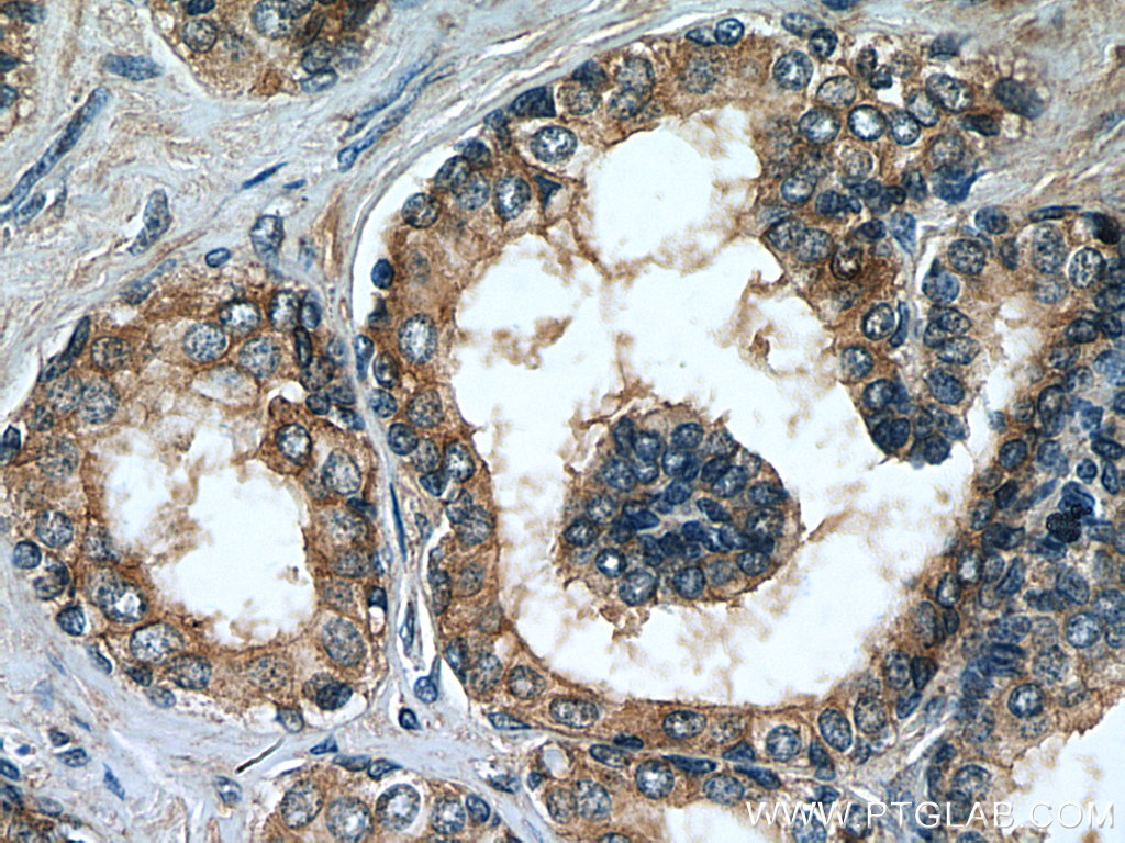 MRP4 Monoclonal antibody