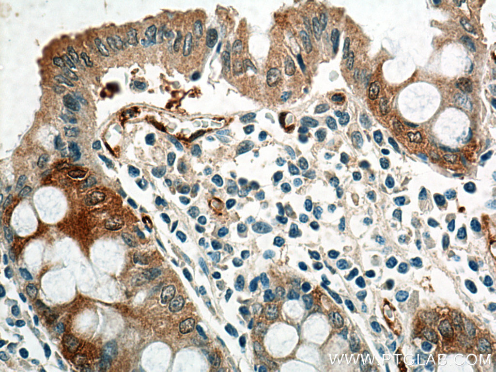 NQO1 Monoclonal antibody