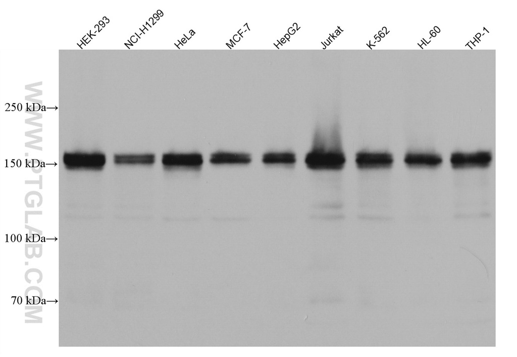 HDAC6 Monoclonal antibody