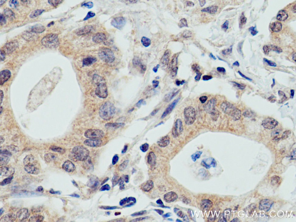 WWP2 Monoclonal antibody