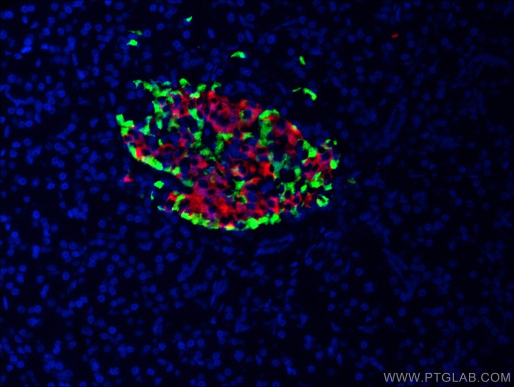 Glucagon Monoclonal antibody