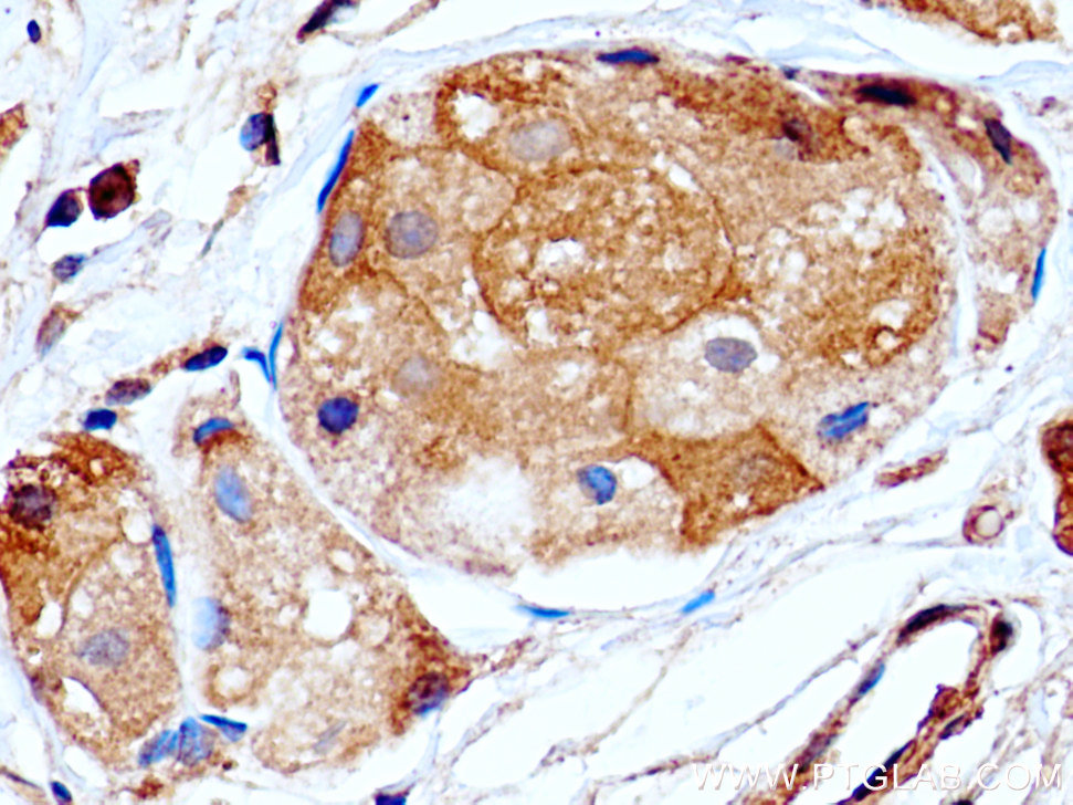 PRLR Monoclonal antibody