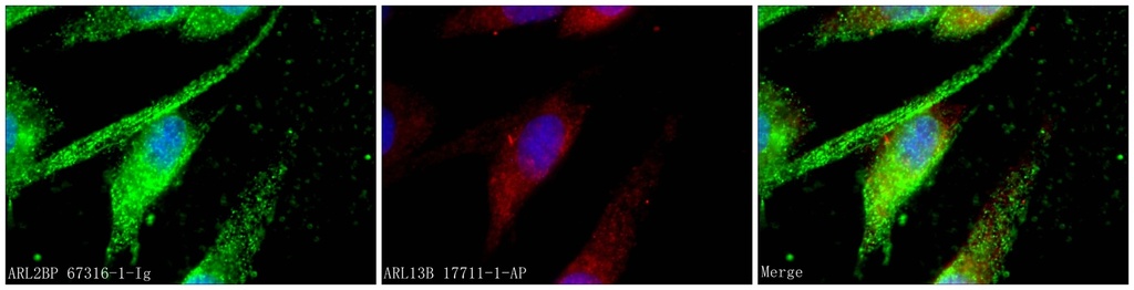 ARL2BP Monoclonal antibody