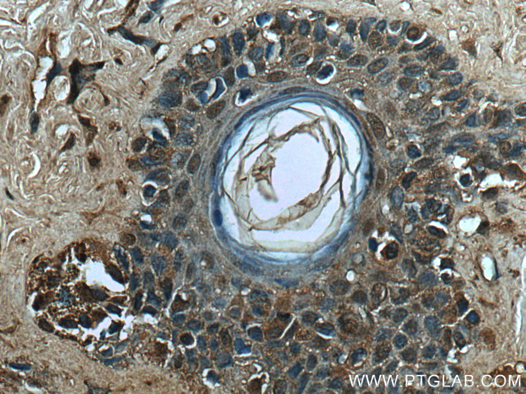TFE3 Monoclonal antibody
