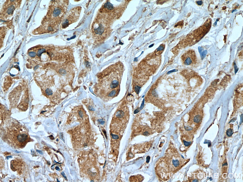 USP8 Monoclonal antibody