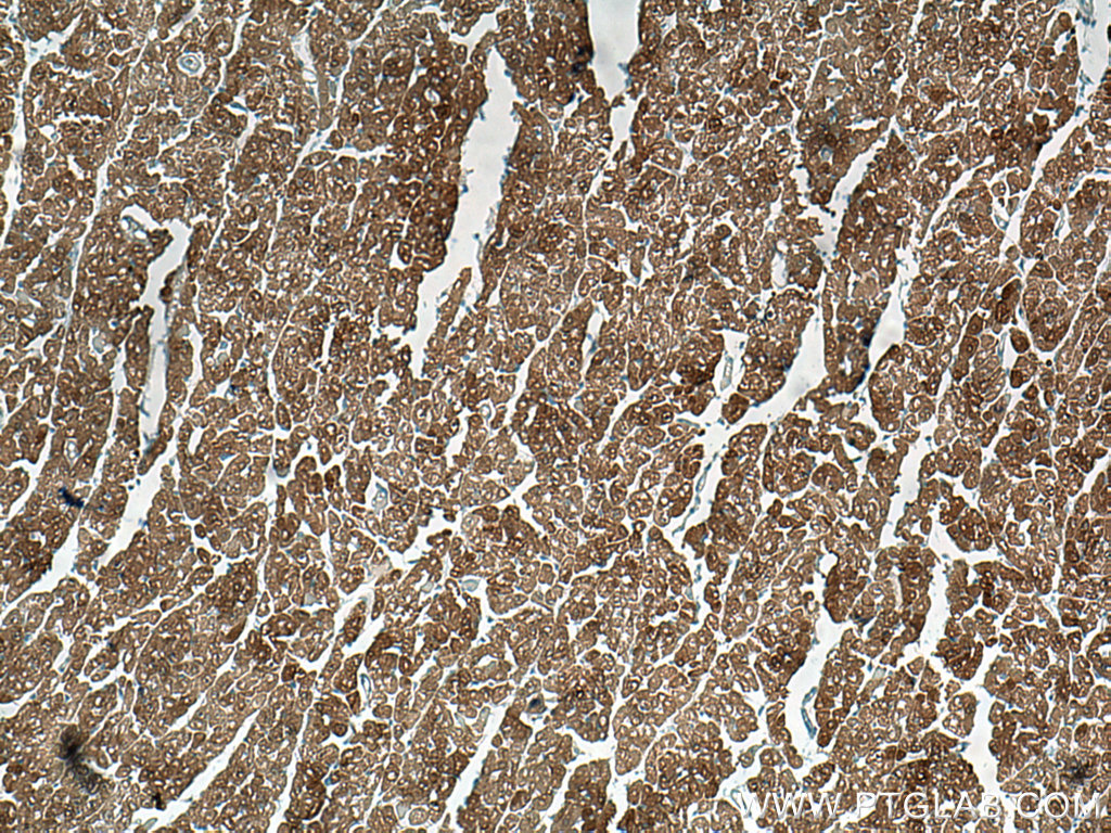HSP20 Monoclonal antibody