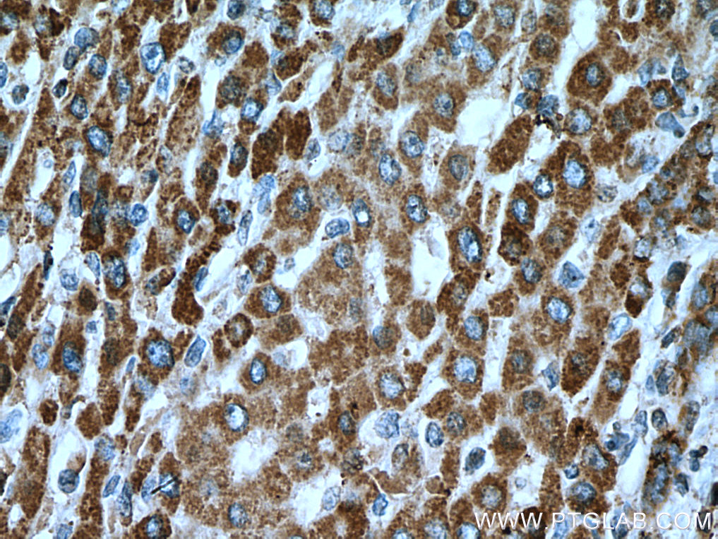 ACSM5 Monoclonal antibody