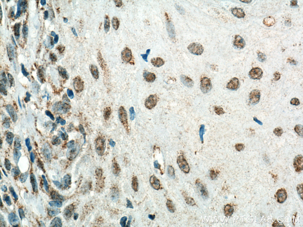HMG20B Monoclonal antibody