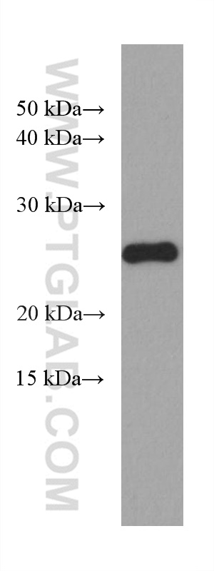 P27; KIP1 Monoclonal antibody