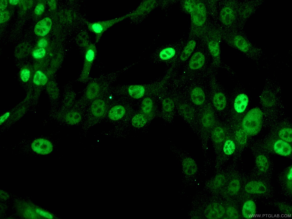 p21 Monoclonal antibody