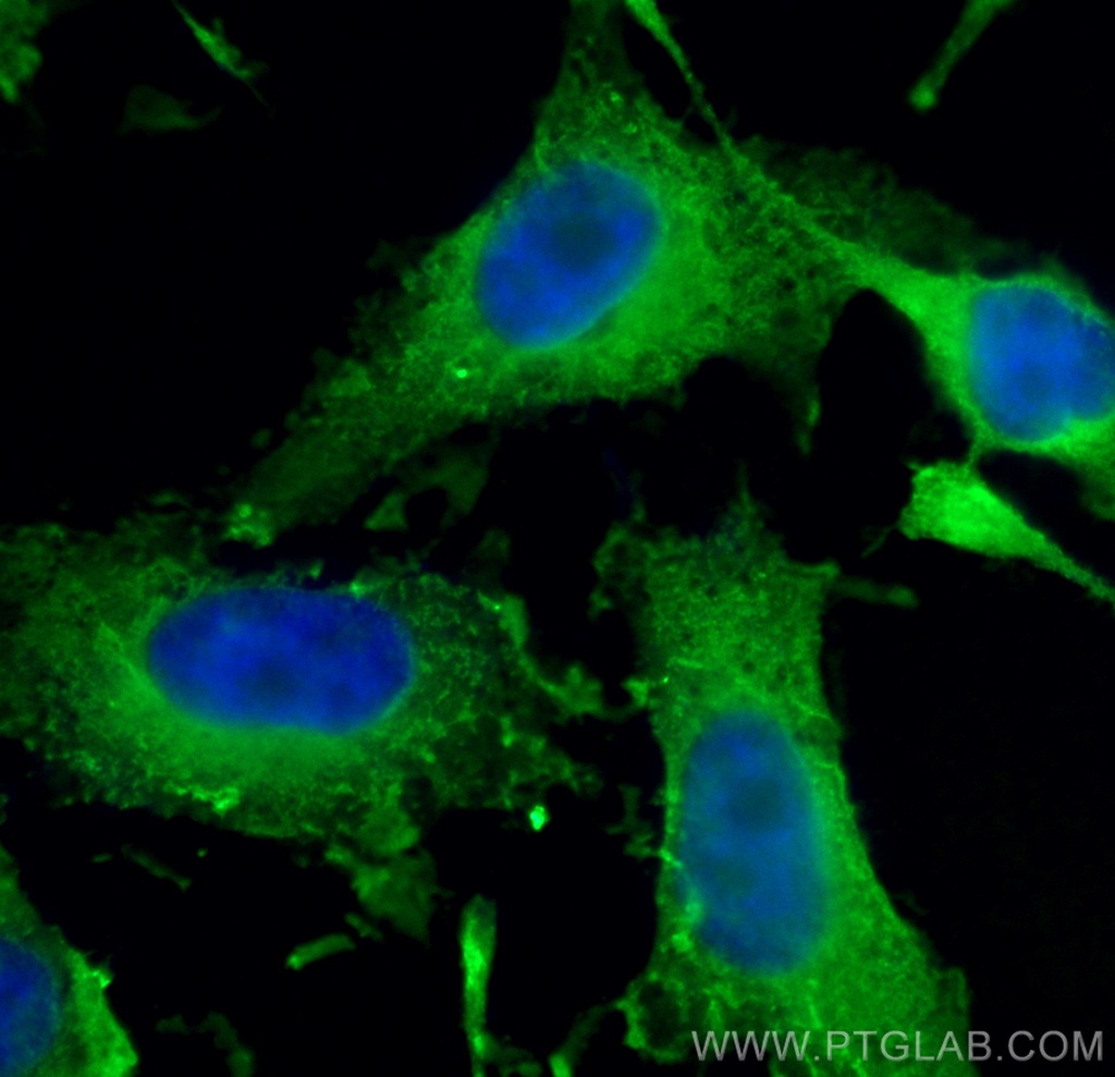 PFN1 Monoclonal antibody