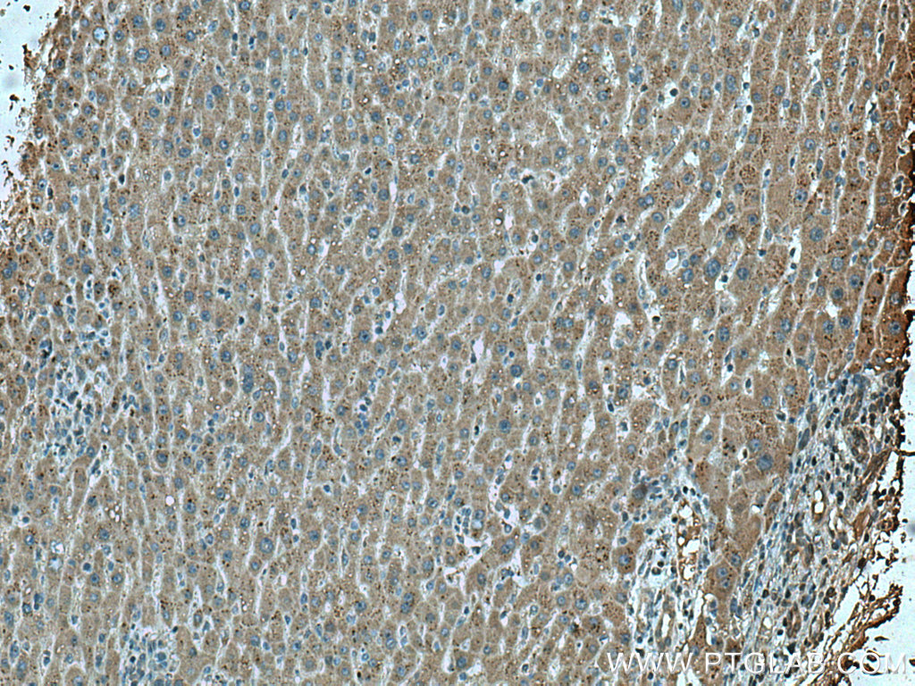 LACTB2 Monoclonal antibody