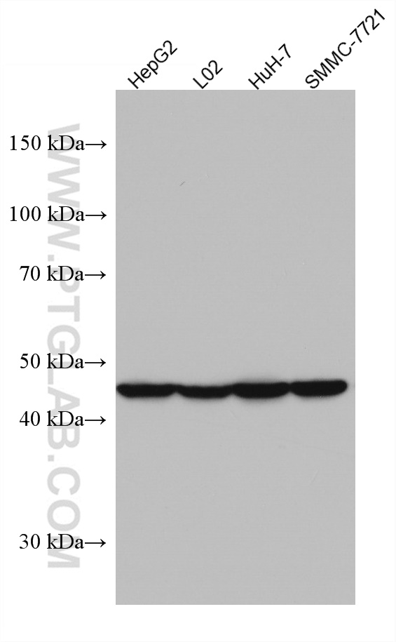 AGXT Monoclonal antibody