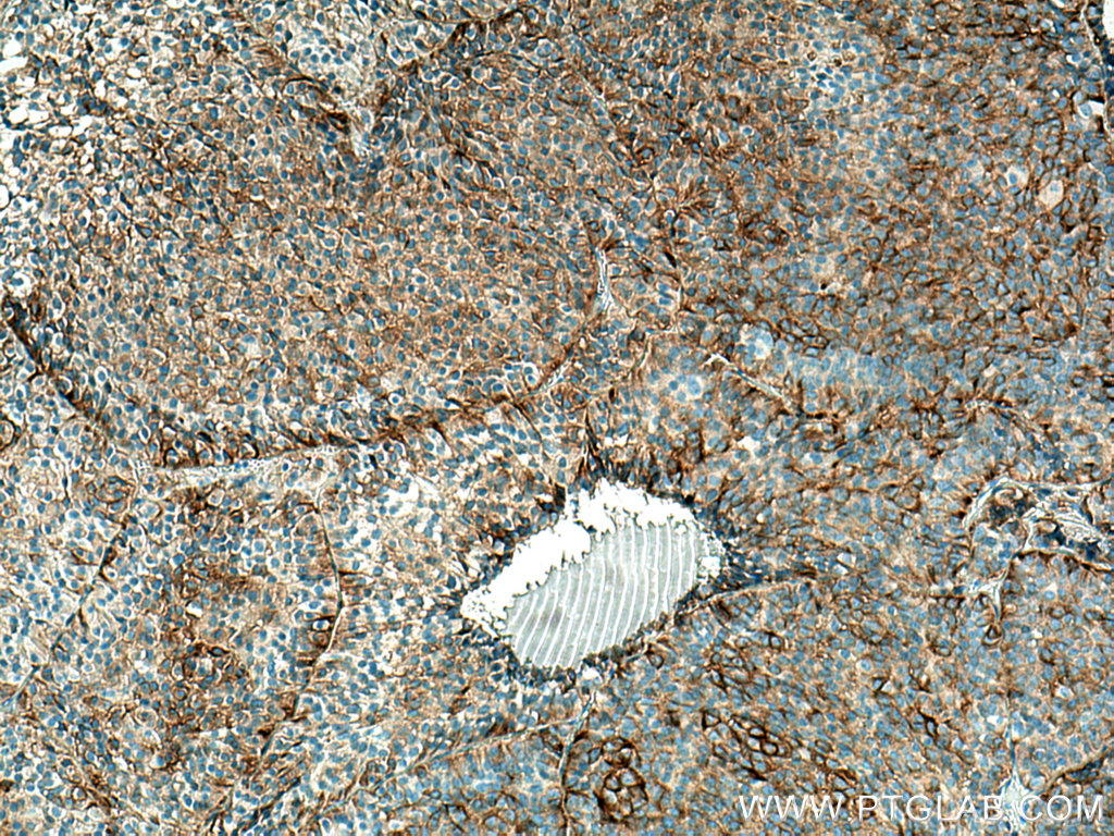 Secretogranin V Monoclonal antibody