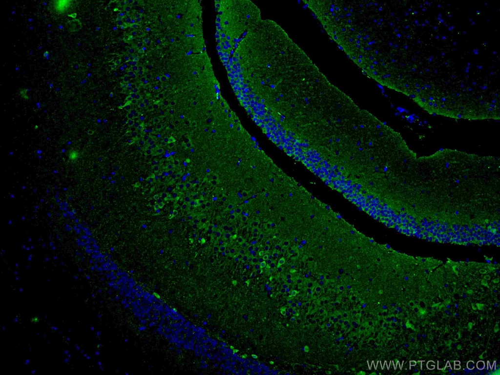 ACVR1 Monoclonal antibody