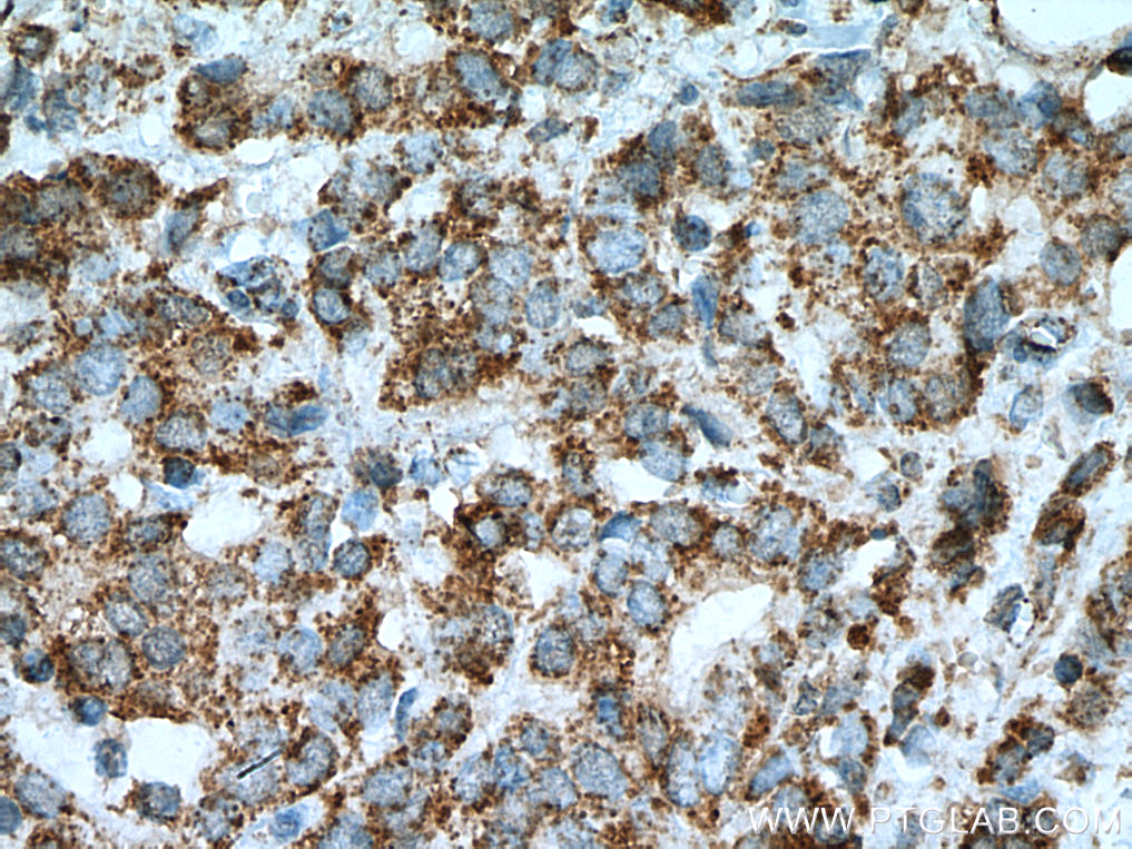 KLK11 Monoclonal antibody