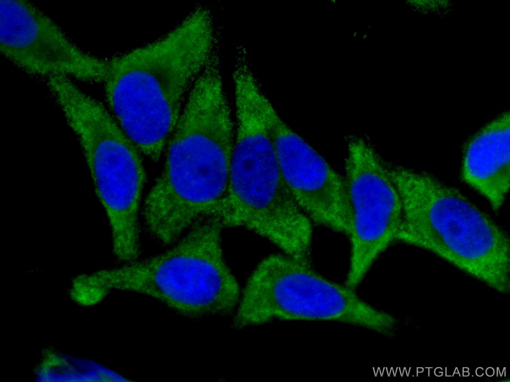 EIF4G2 Monoclonal antibody