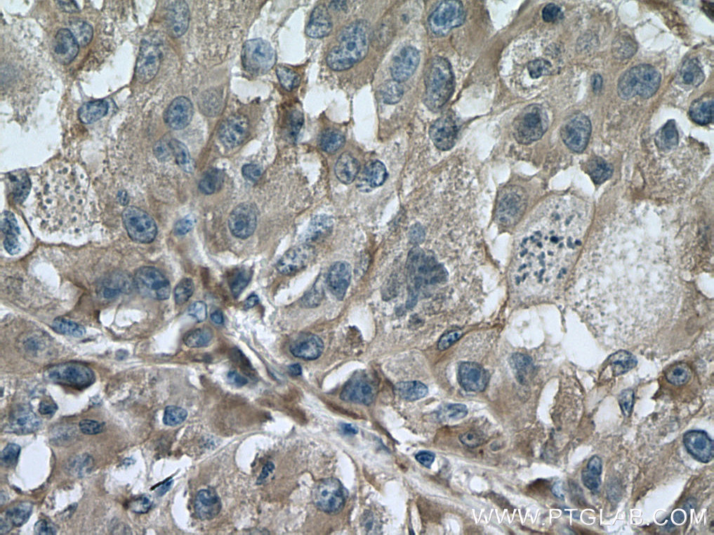 TTPA Monoclonal antibody