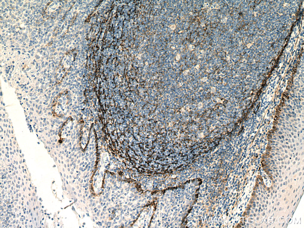 Podoplanin Monoclonal antibody