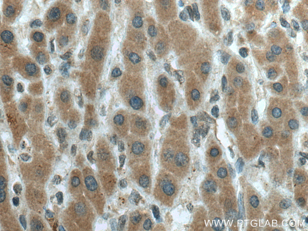 CYP20A1 Monoclonal antibody