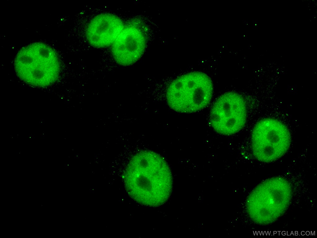 PTBP1 Monoclonal antibody