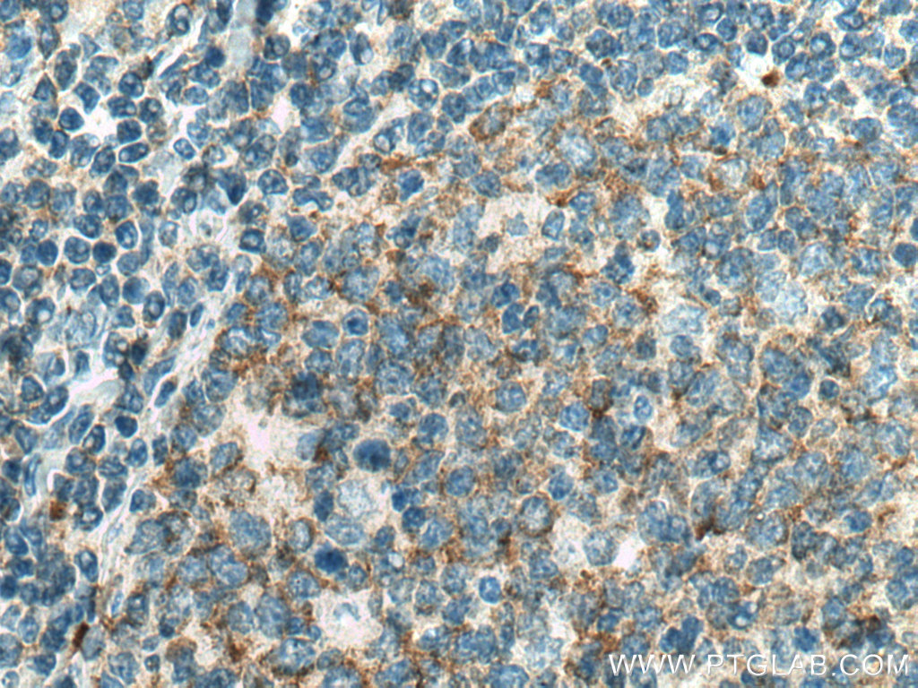 PIP5K1A Monoclonal antibody
