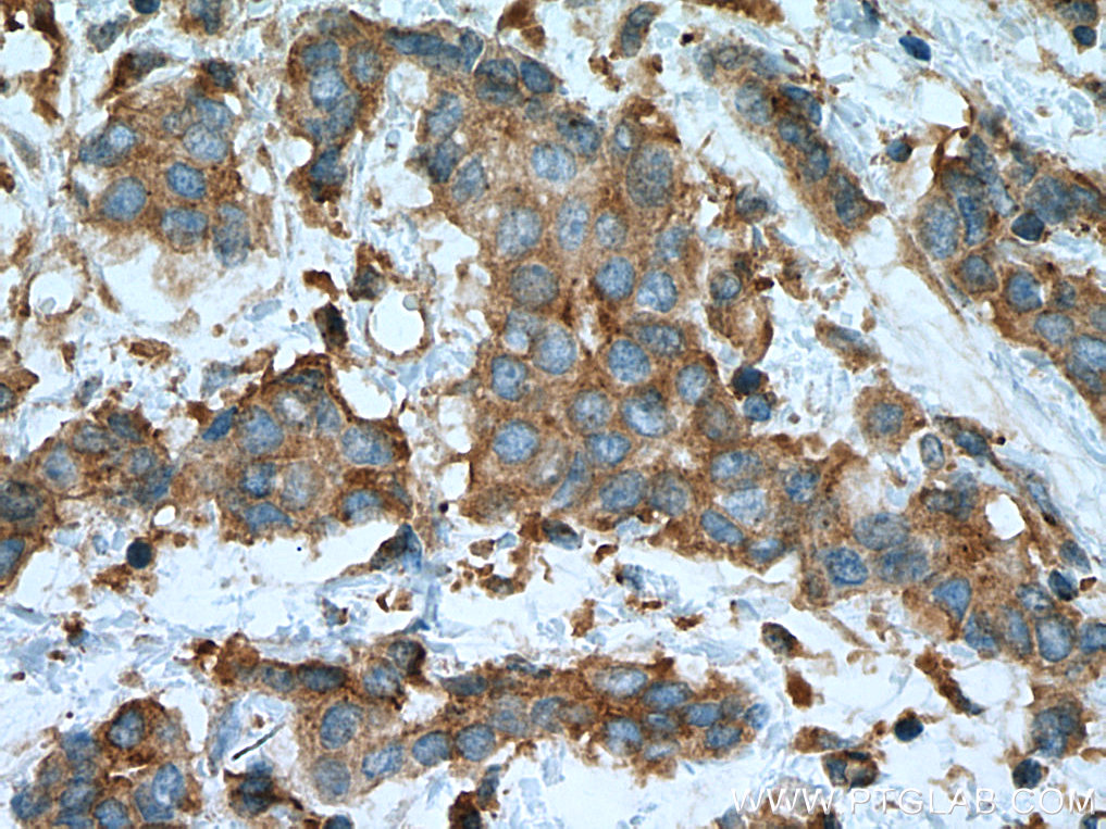 PRKACA Monoclonal antibody