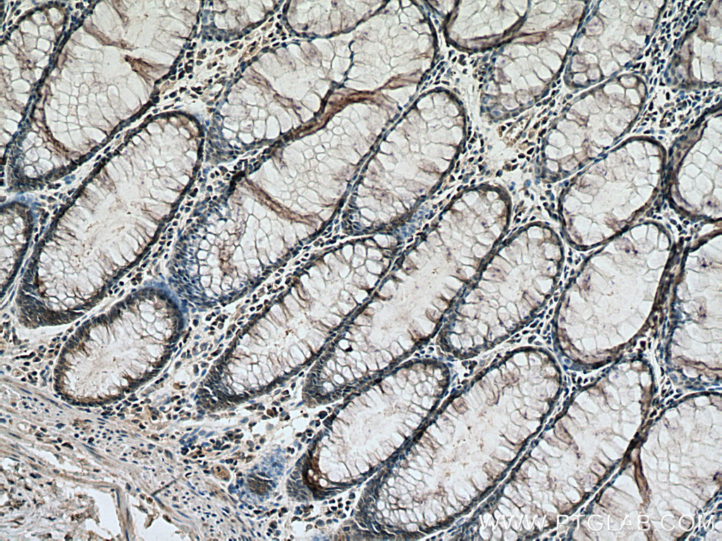 RAN Monoclonal antibody