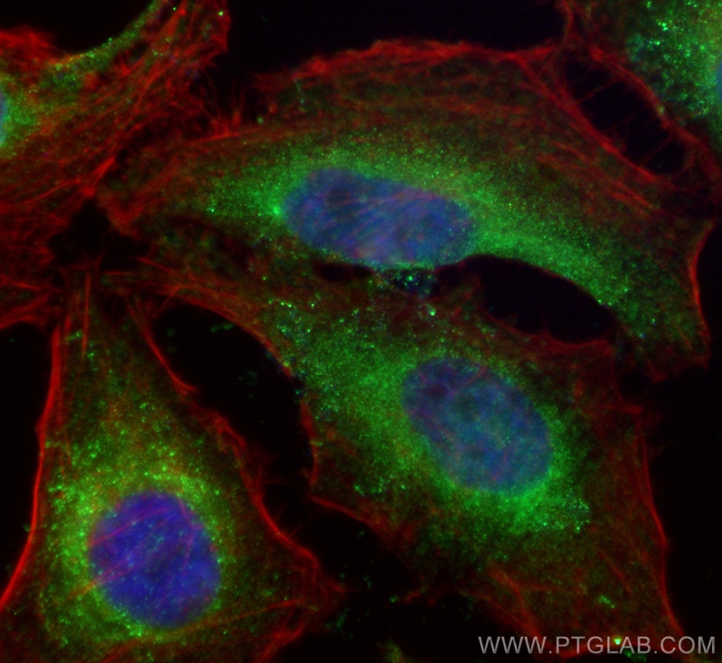 RHOBTB3 Monoclonal antibody