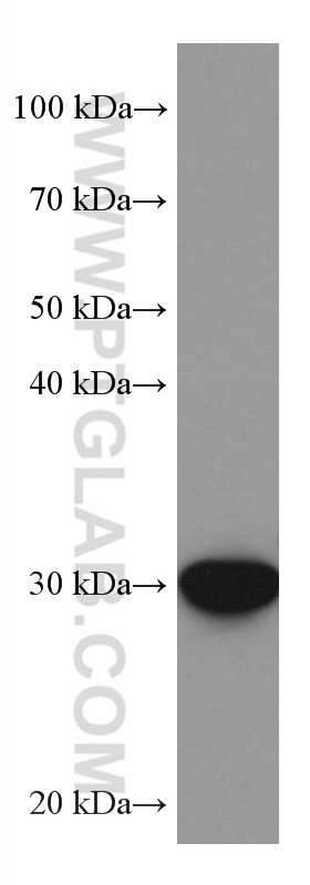 PIR Monoclonal antibody
