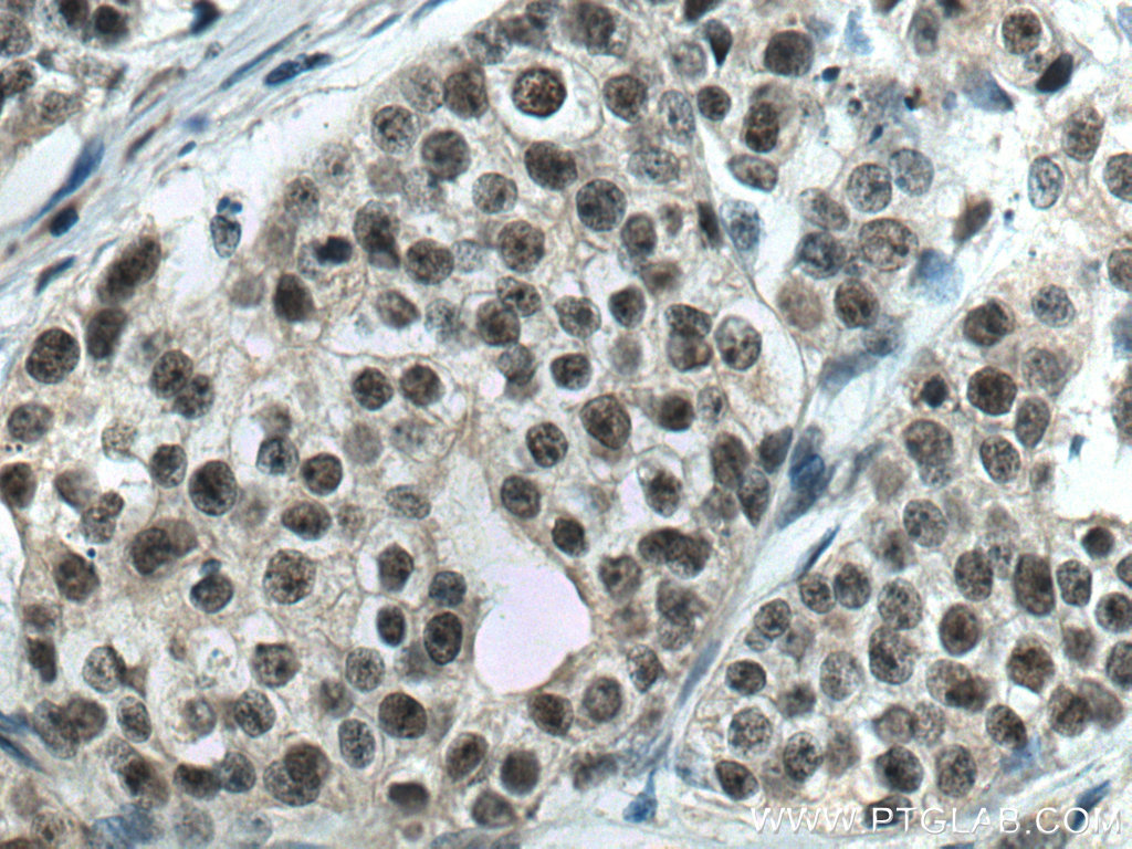 PDS5A Monoclonal antibody