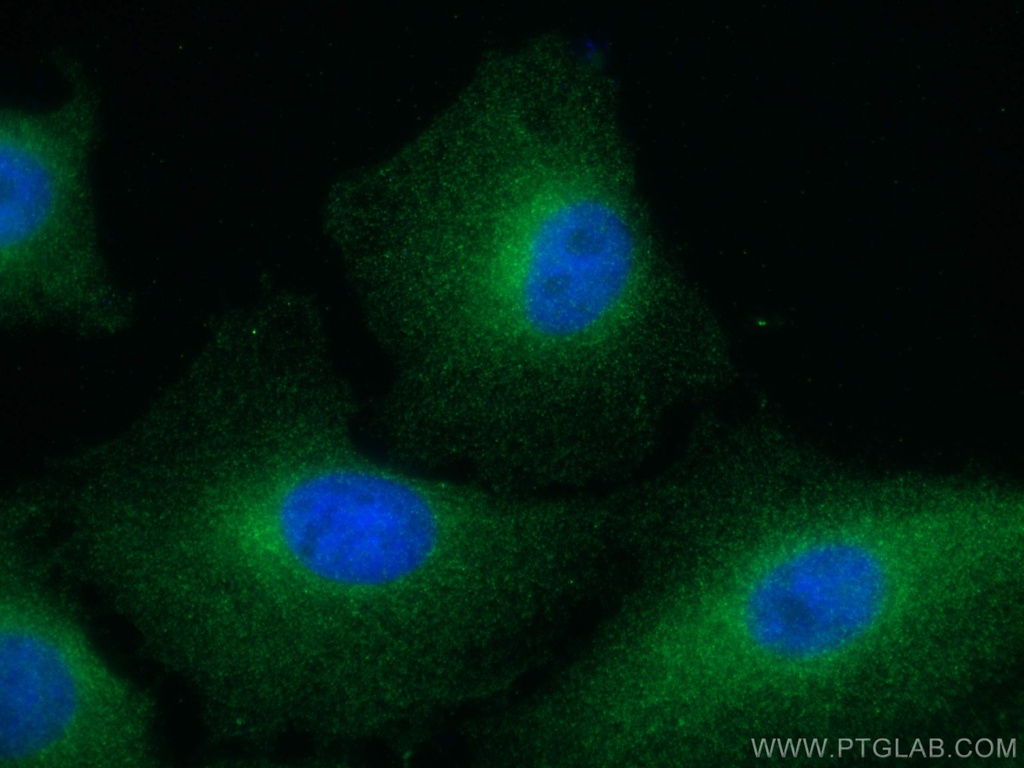 FES Monoclonal antibody
