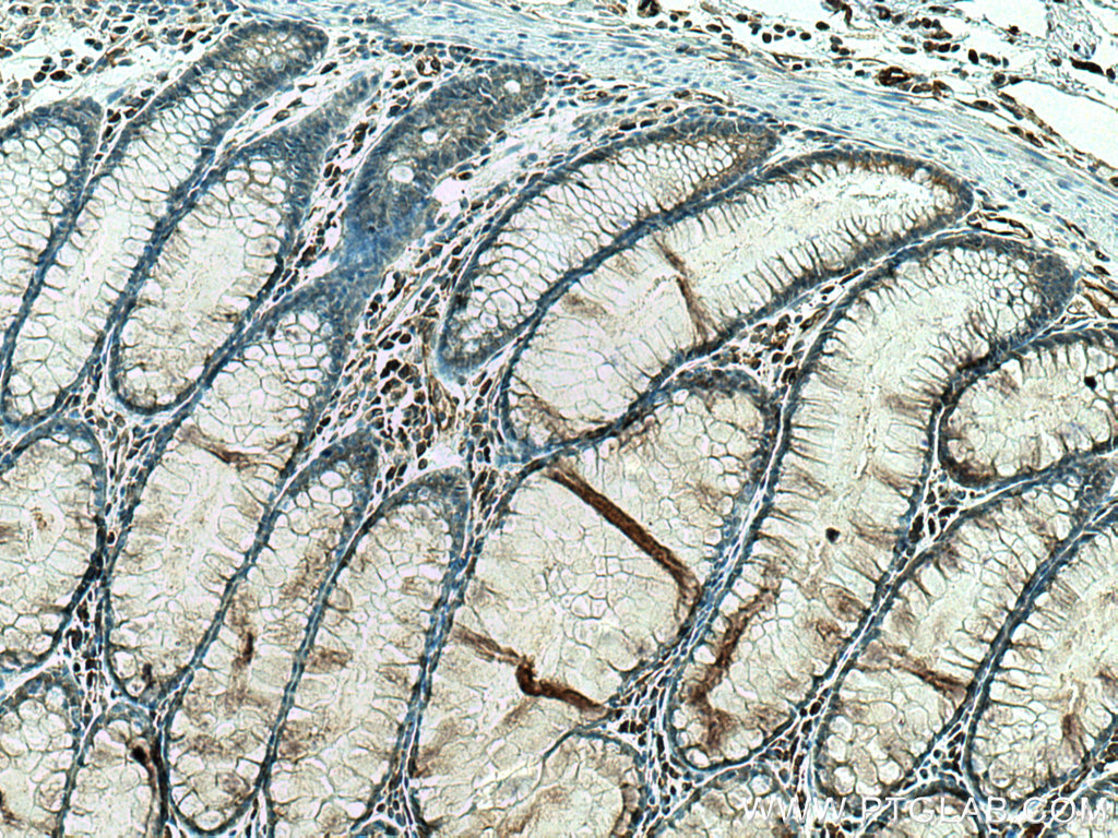 STK32A Monoclonal antibody