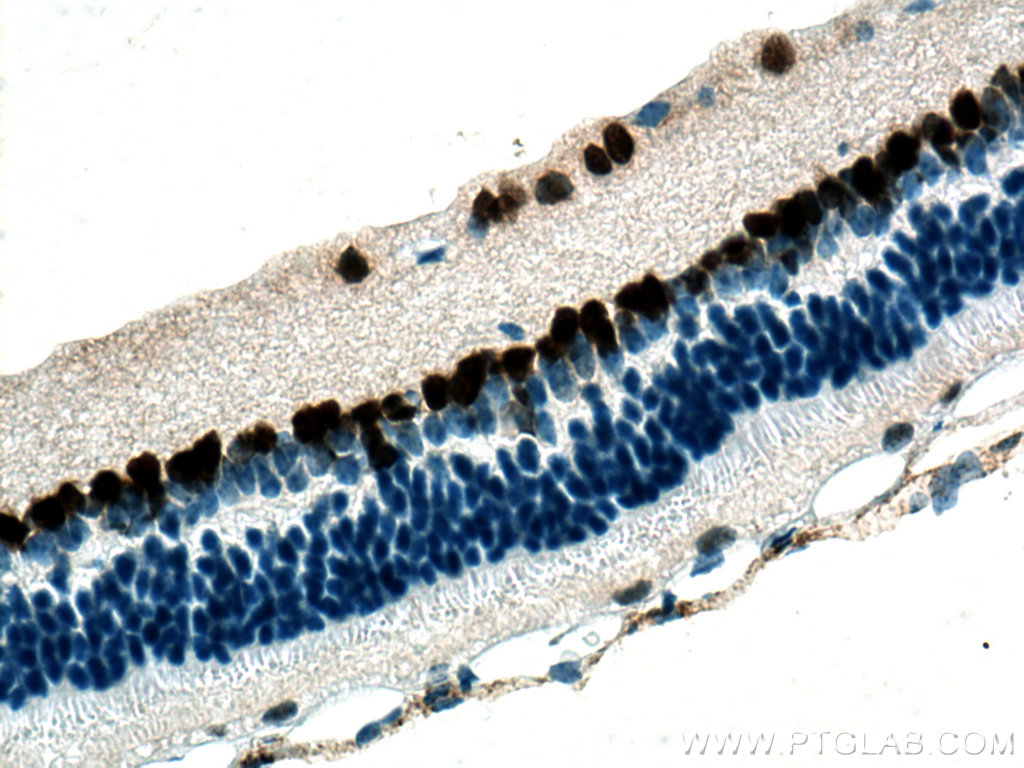 PAX6 Monoclonal antibody