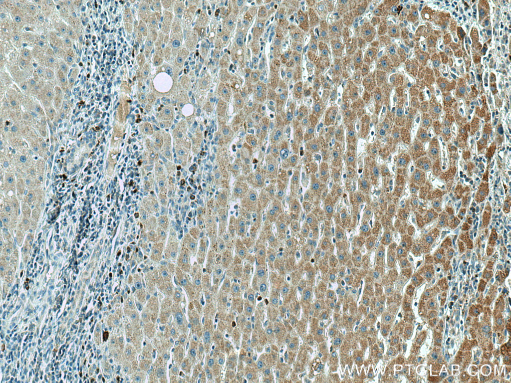 AMT Monoclonal antibody