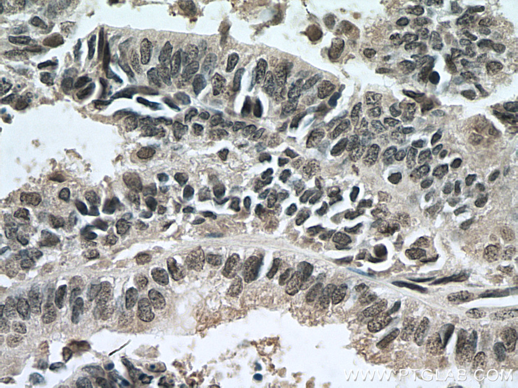 RBM8A,Y14 Monoclonal antibody