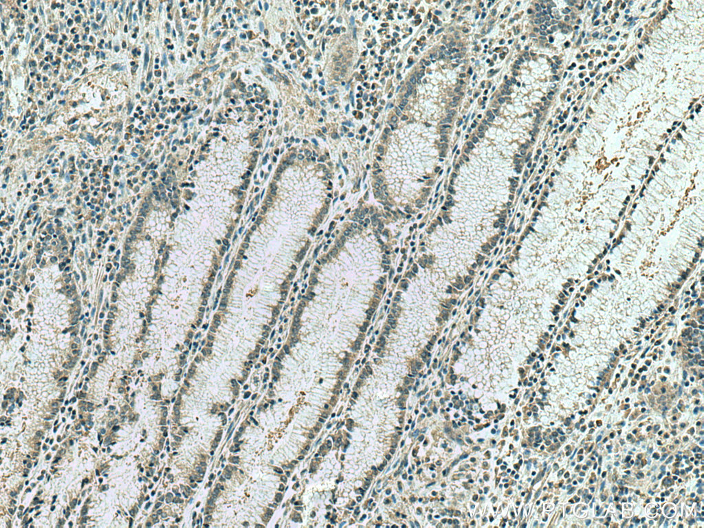 IPO4 Monoclonal antibody