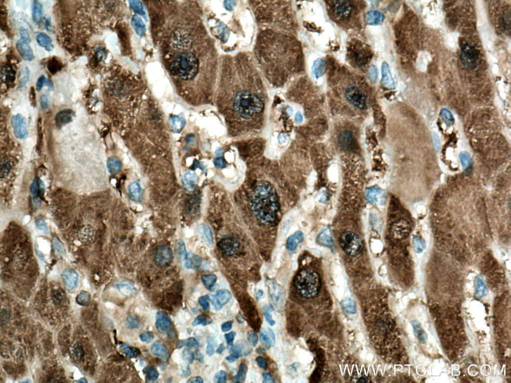 HPD Monoclonal antibody