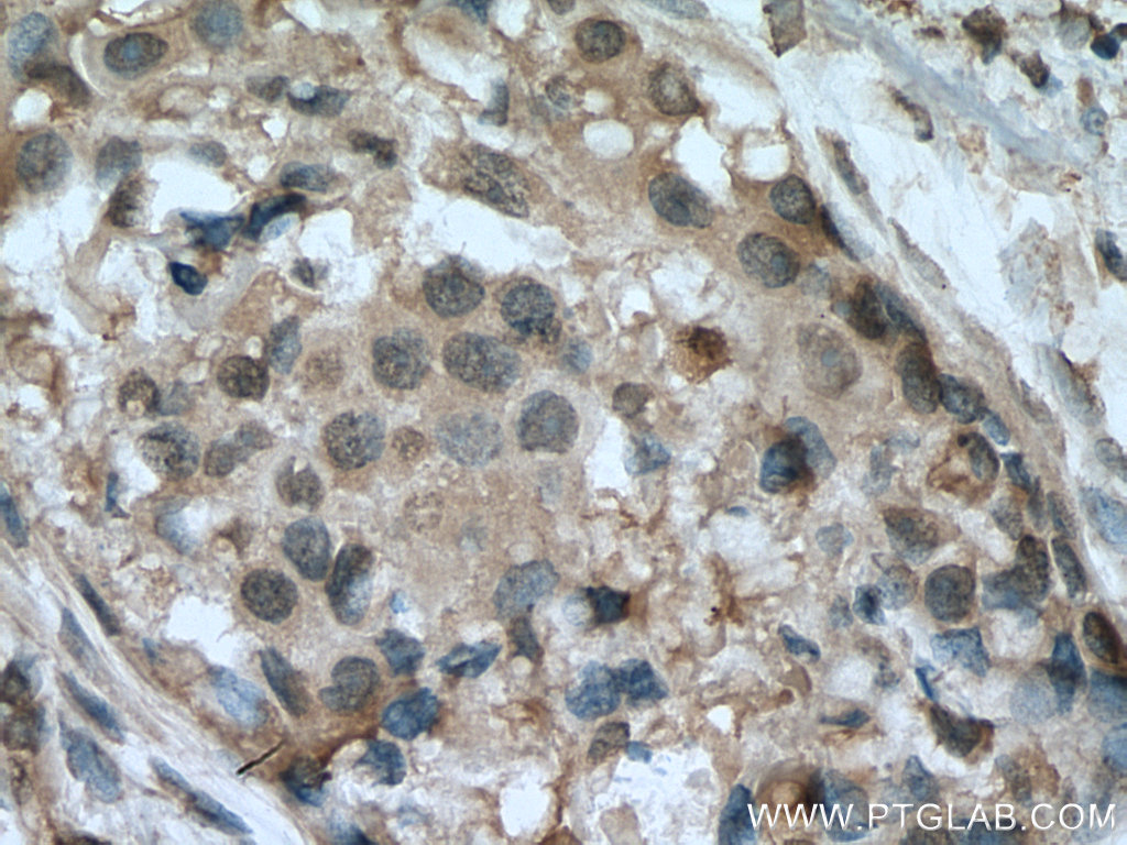 HINT1 Monoclonal antibody