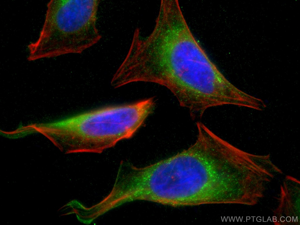 Calumenin Monoclonal antibody