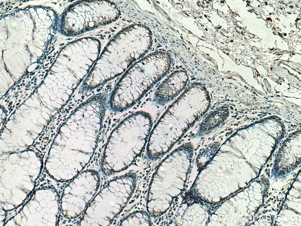 Importin Beta Monoclonal antibody