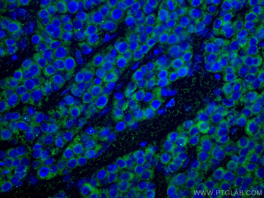 SDHB Monoclonal antibody