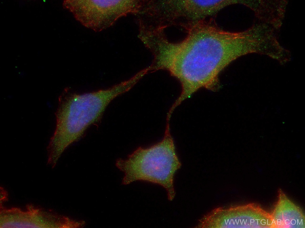 CCDC6 Monoclonal antibody