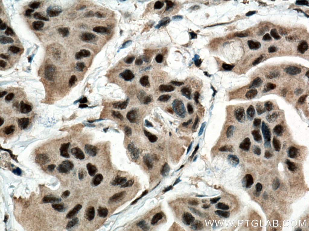 BAT1 Monoclonal antibody