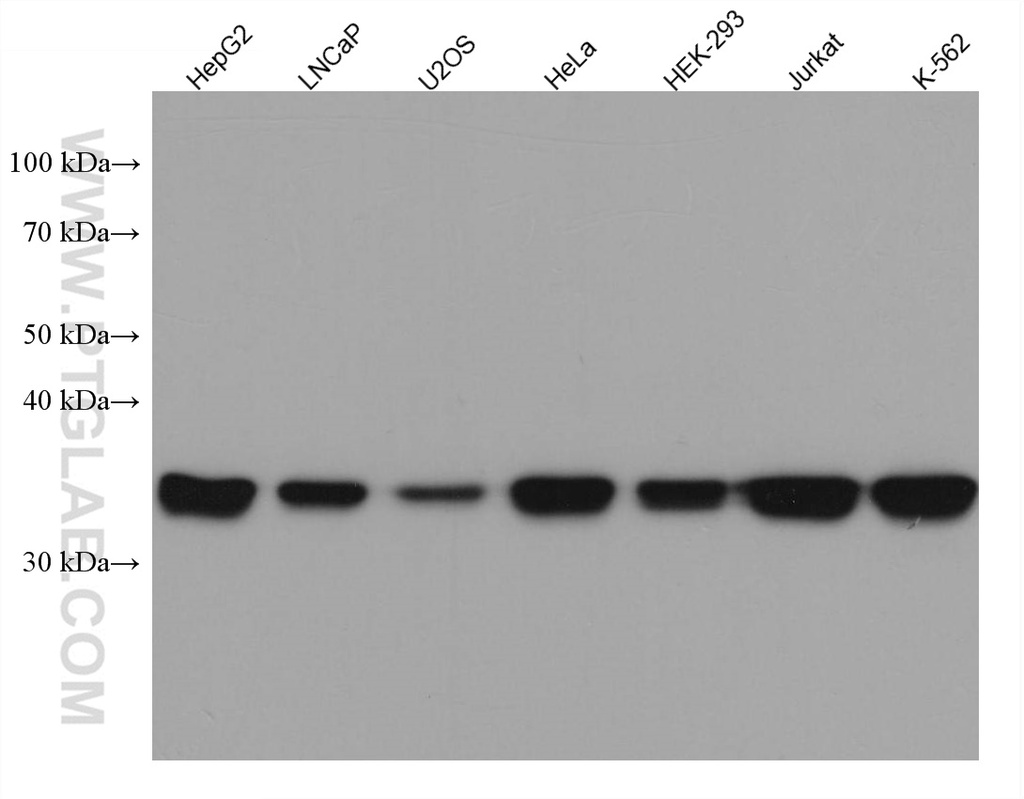 MAT2B Monoclonal antibody