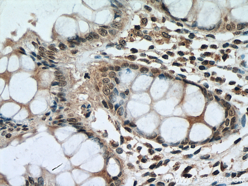 PI3 Kinase p85 Beta Monoclonal antibody
