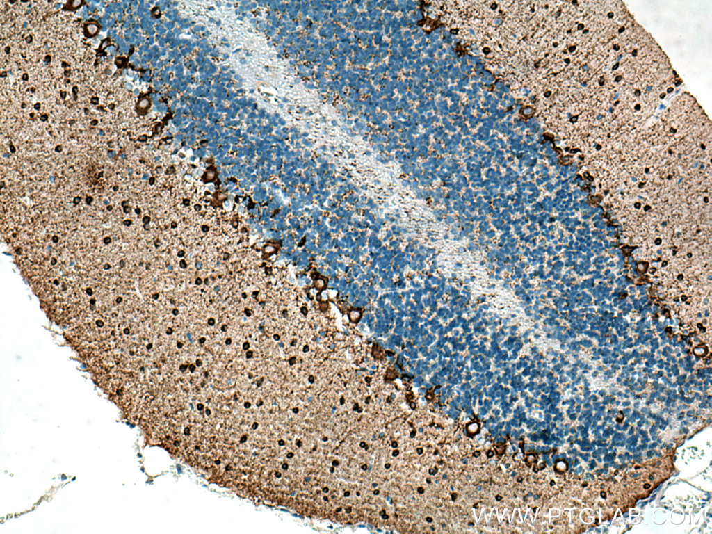 GAD1 Monoclonal antibody