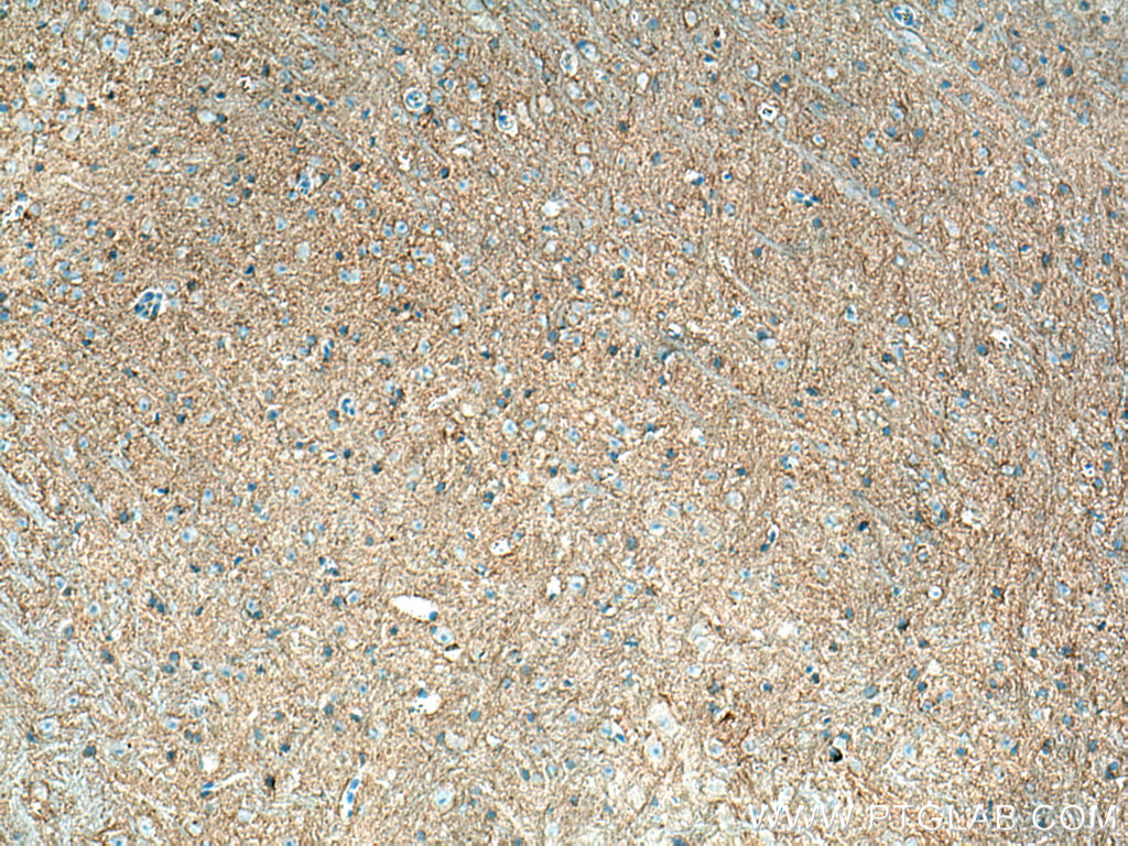 P2RY1 Monoclonal antibody