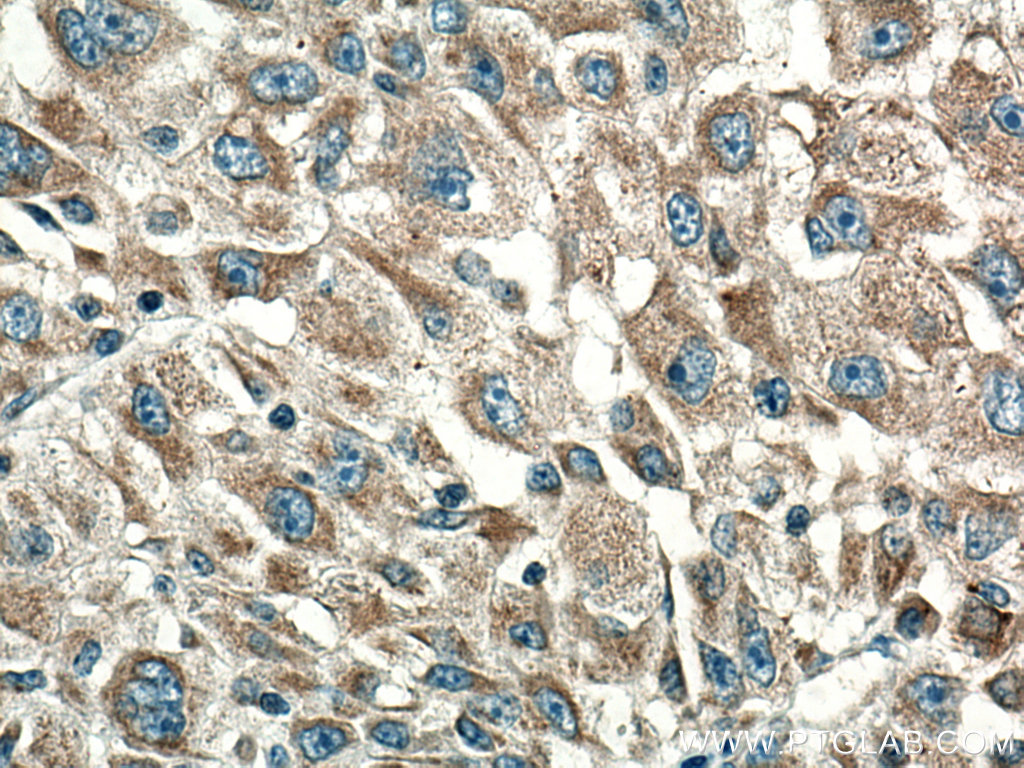 CYR61 Monoclonal antibody