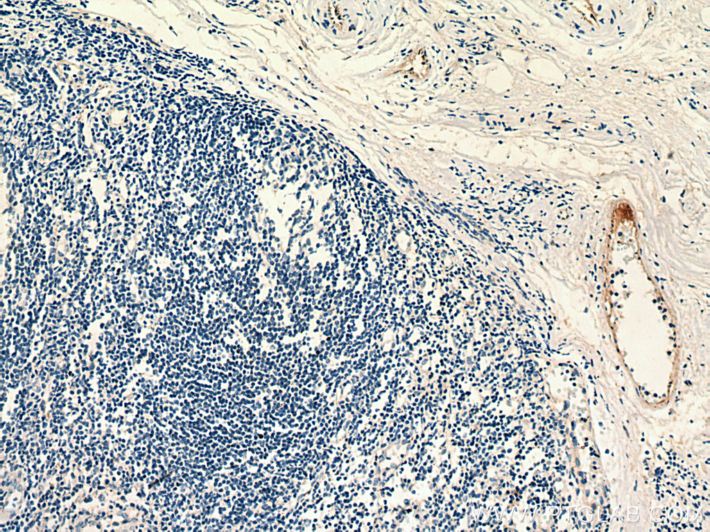 PROCR Monoclonal antibody
